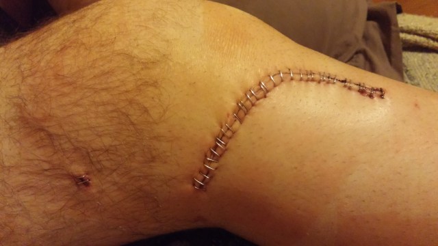 Eeew! Look at that boo boo! There is one more small incision near his ankle, too.